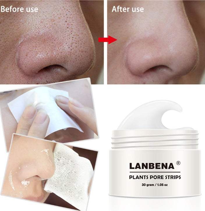 Visible blackhead reduction on nose before and after using Lanbena Advanced Blackhead Remover & Nasal Membrane Kit with pore strips.