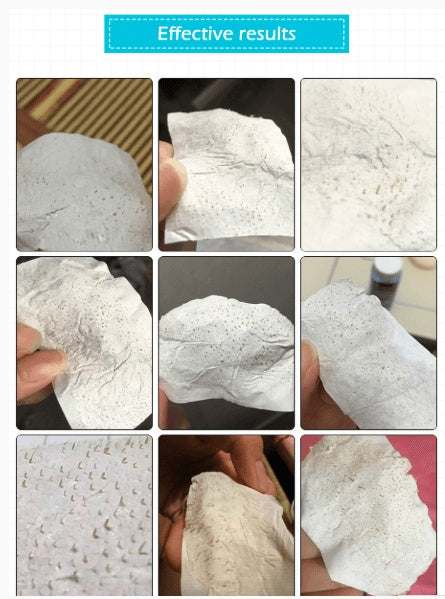 Used pore strips from Advanced Blackhead Remover & Nasal Membrane Kit showing extracted blackheads for effective deep pore cleansing.