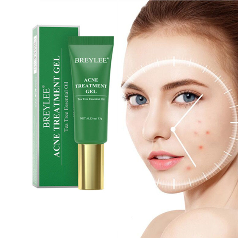 🌿 Acne Scar Removal Gel – Heal, Brighten & Restore