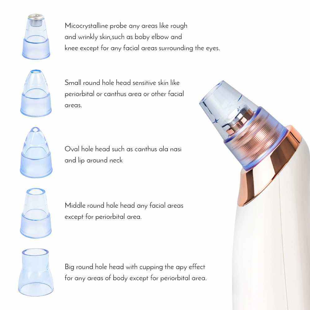Blackhead Artifact Electric Acne Machine - Joynfunmall