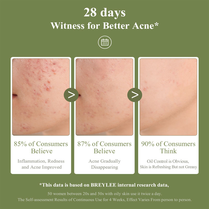 🌿 Acne Scar Removal Gel – Heal, Brighten & Restore