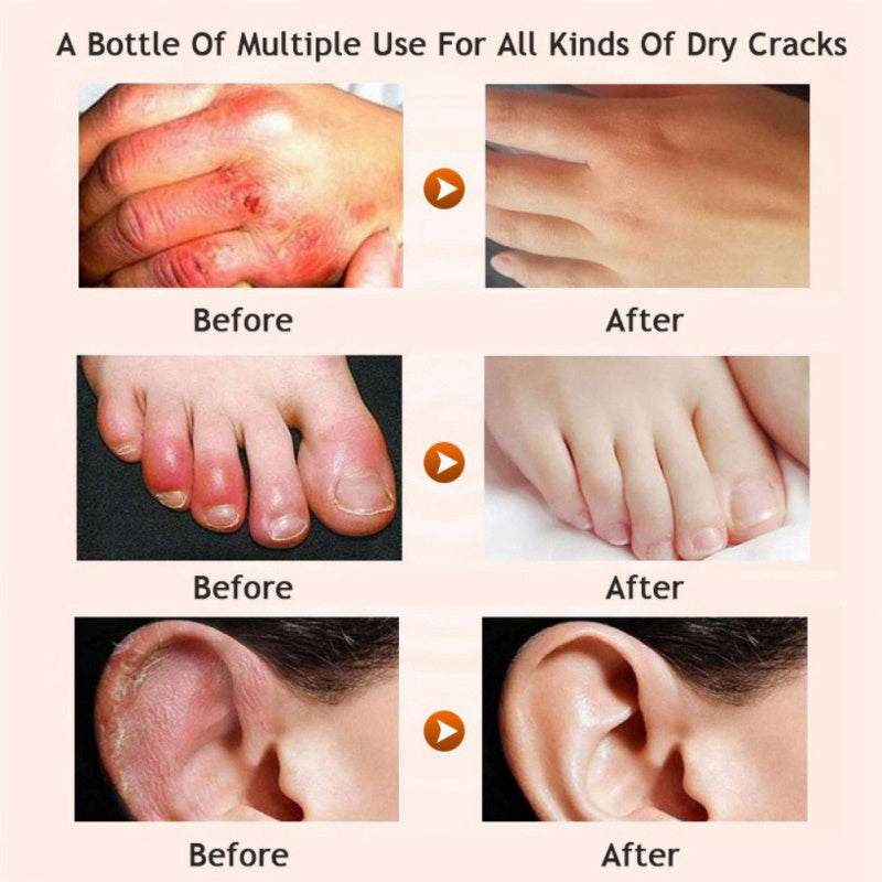 Best moisturizer for dry skin with natural honey extract

