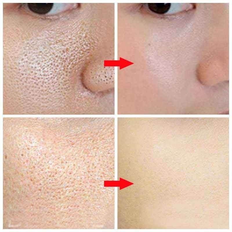 Best serum to tighten pores and improve skin texture