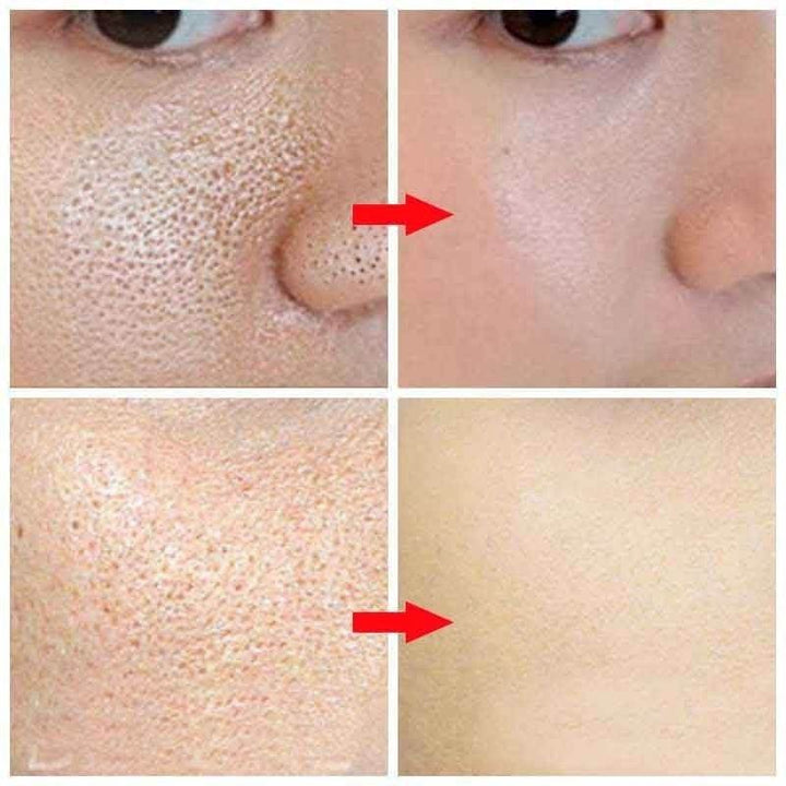Best serum to tighten pores and improve skin texture