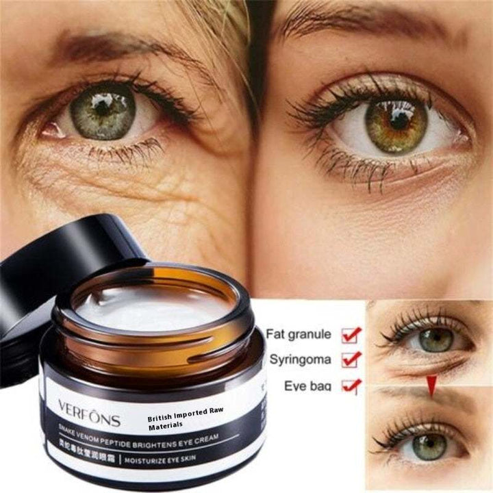 Top Rated Best Firming Eye Cream with Retinol reduces wrinkles, eye bags, and syringoma with visible before-and-after results for under-eye care.