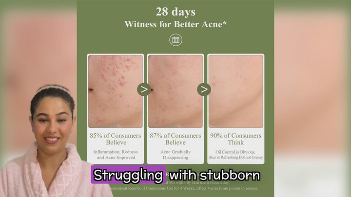 🌿 Acne Scar Removal Gel – Heal, Brighten & Restore
